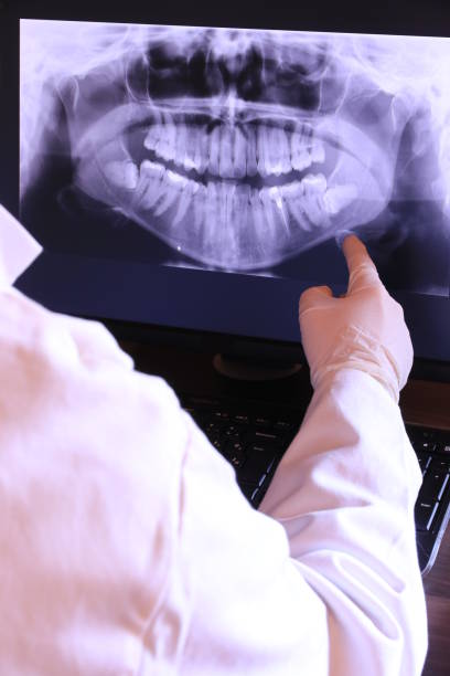 Best Chipped Tooth Repair Near Me  in Des Moines, WA